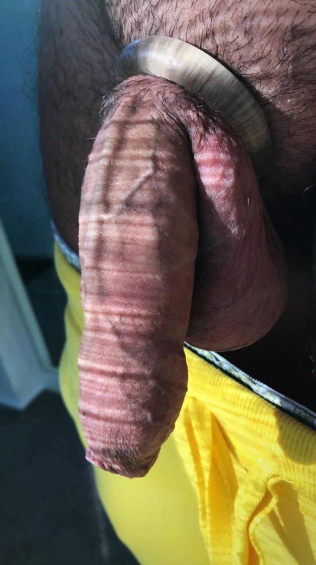 Photo by OzNudeUncut with the username @OzNudeUncut, who is a verified user,  June 29, 2022 at 4:10 PM. The post is about the topic Veiny Cock and the text says 'Blood is pumping through those veins
#foreskin #cockring #veinycock'