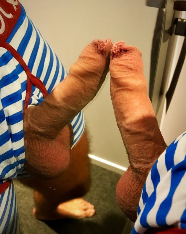 Photo by OzNudeUncut with the username @OzNudeUncut, who is a verified user,  May 4, 2022 at 12:23 PM. The post is about the topic Uncut cocks and the text says 'Twins
#uncut #foreskin #cock'