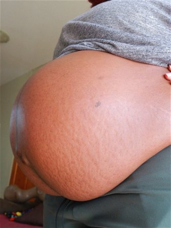 PregnantBelly
