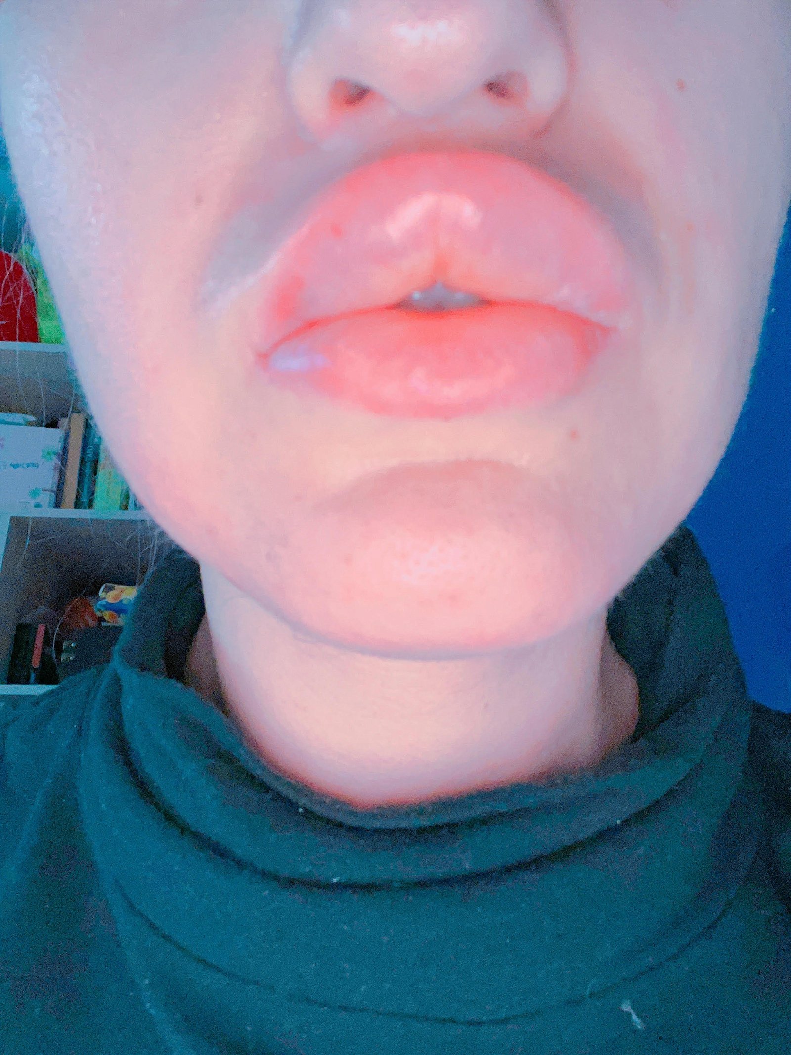 Watch the Photo by FinDom Goaldigger with the username @findomgoaldigger, who is a star user, posted on October 31, 2022 and the text says 'Lip Fillers Donation Target for BIG LIPS LOVERS! Pay for my fillers in my lips what I did this Friday! 28.10.2022 It cost 400$ #lipsfetish #biglips #fulllips TIP IN ONLYFANS OR  LOYALFANS + manyvids, clips4sale, iwantclips'