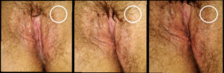 Photo by Loraxteacher with the username @Loraxteacher, who is a verified user,  August 28, 2020 at 5:05 PM. The post is about the topic Hairy pussies and the text says 'chubby slutty wifes used up pussy when she refuses to shave'