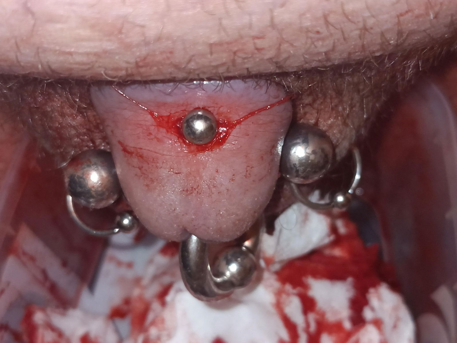 Album by Rhyd1978 with the username @Rhyd1978,  October 17, 2023 at 12:43 PM. The post is about the topic Cock Piercings