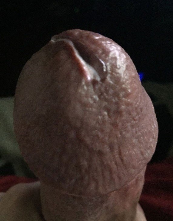 Photo by Bunny with the username @BunnyDick,  May 6, 2021 at 3:10 PM. The post is about the topic close-ups and the text says 'Roundy & leaky
#me #cock #penis #dick #closeup #glans #shroom #precum #pov'