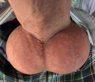 Photo by Bunny with the username @BunnyDick,  July 8, 2022 at 10:46 PM. The post is about the topic Balls and the text says 'You Drain those Bags - You Keep the Cum
#me #balls #testicles #scrotum'