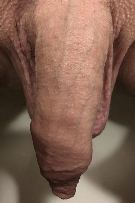 Photo by the foreskin is good with the username @theforeskinisgood, who is a verified user,  July 19, 2019 at 9:01 AM and the text says 'How wonderfully the foreskin is tightly closed and forming a sensitive nipple'