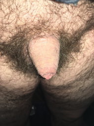 Photo by Trampsvest with the username @Trampsvest,  March 4, 2024 at 3:07 PM. The post is about the topic Uncut cocks and the text says 'Does anyone like my small hairy one?'