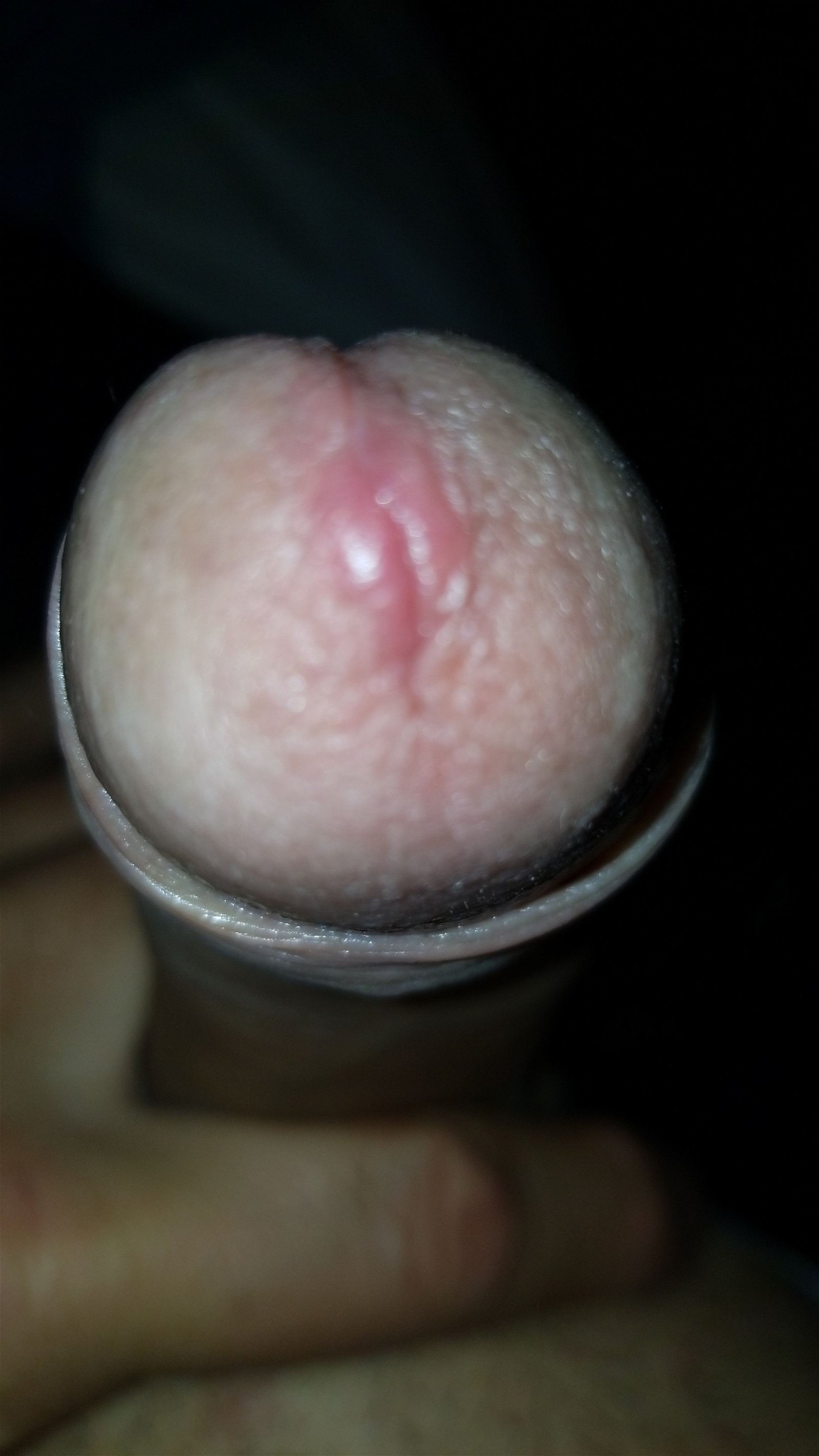 Photo by Vulcan19 with the username @Vulcan19,  April 10, 2024 at 5:23 AM. The post is about the topic penileforeskin